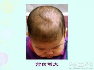 嬰兒嚴重缺鈣怎麼辦