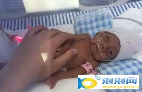深圳九爺出生僅500克 24周早產兒存活征服網友 24周早產兒存活出僅500克 被取名九爺征服網友