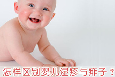 寶寶痱子怎麼辦?